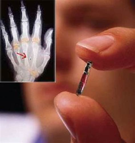 rfid chip insertion into hand photos|handheld microchip implants.